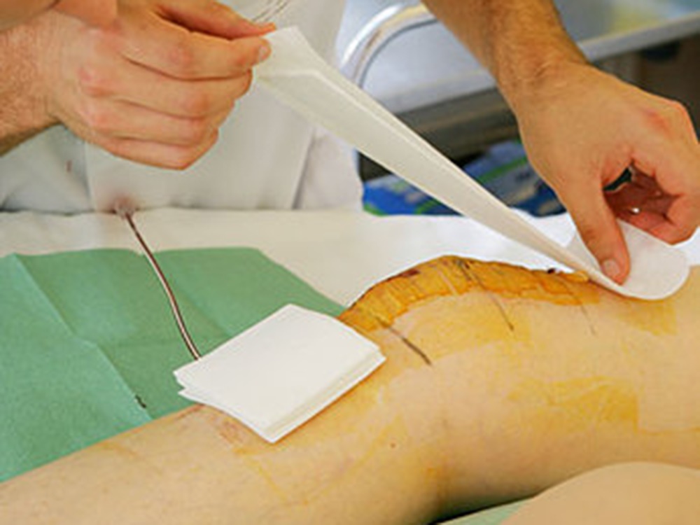 advanced wound 8 advanced wound 8